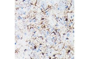Immunohistochemistry of paraffin-embedded mouse brain using GFAP Rabbit mAb (ABIN7267389) at dilution of 1:100 (40x lens). (GFAP 抗体)