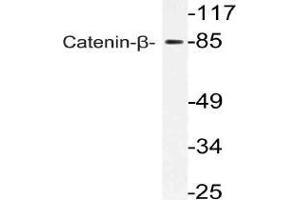 Western blot (WB) analysis of Catenin-beta antibody in extracts from 293 cells. (CTNNB1 抗体)