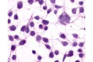 Anti-GRM3 / MGLUR3 antibody immunocytochemistry (ICC) staining of untransfected HEK293 human embryonic kidney cells. (Metabotropic Glutamate Receptor 3 抗体  (N-Term))