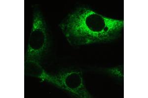 Immunohistochemistry (IHC) image for anti-Myosin Phosphatase, Target Subunit 1 (PPP1R12A) (AA 1-40), (N-Term) antibody (ABIN3043902)