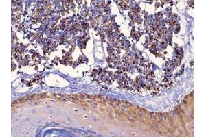 Immunohistochemistry (IHC) image for anti-Keratin 18 (KRT18) (C-Term) antibody (ABIN870569) (Cytokeratin 18 抗体  (C-Term))