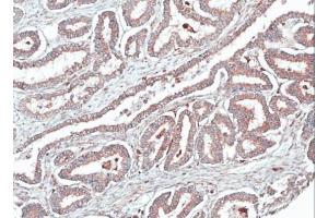 Immunohistochemistry (IHC) image for anti-Homer Homolog 1 (HOMER1) (Center) antibody (ABIN2855600)