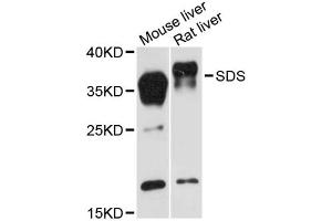 Western blot analysis of extracts of various cell lines, using SDS antibody (ABIN6293759) at 1:3000 dilution. (serine Dehydratase 抗体)