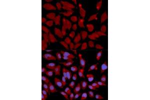 Immunofluorescence analysis of U2OS cell using DNMT3A antibody. (DNMT3A 抗体  (AA 500-700))