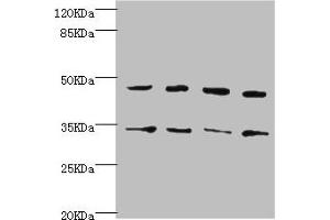 Western blot All lanes: CYTH2 antibody at 5. (Cytohesin 2 抗体  (AA 150-350))