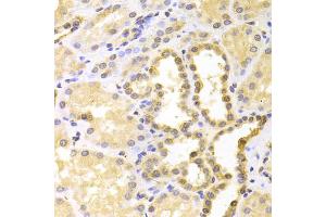 Immunohistochemistry of paraffin-embedded human kidney using S100A11 antibody (ABIN5973196) at dilution of 1/100 (40x lens).