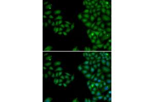 Immunofluorescence (IF) image for anti-Neurofilament, Light Polypeptide (NEFL) (AA 400-543) antibody (ABIN6213733) (NEFL 抗体  (AA 400-543))