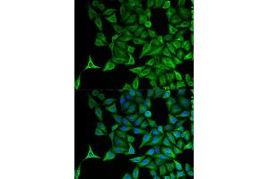Immunofluorescence analysis of HeLa cell using KRT20 antibody.