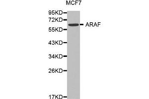 Western blot analysis of extracts of MCF7 cell lines, using ARAF antibody. (ARAF 抗体)
