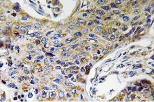 Immunohistochemistry (Paraffin-embedded Sections) (IHC (p)) image for anti-ATP Synthase, H+ Transporting, Mitochondrial Fo Complex, Subunit J2 (ATP5J2) (Subunit F) antibody (ABIN498517)