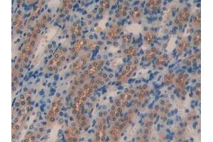 Immunohistochemistry (IHC) image for anti-Klotho beta (KLB) (AA 380-506) antibody (ABIN7438571)