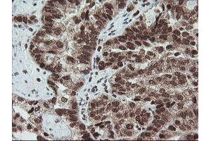 Image no. 7 for anti-Fetal and Adult Testis Expressed 1 (FATE1) antibody (ABIN1498222)