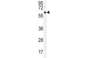 Western Blotting (WB) image for anti-V-Akt Murine Thymoma Viral Oncogene Homolog 1 (AKT1) (AA 428-457) antibody (ABIN3029453)