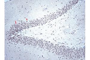 Immunohistochemical staining of neurons in rat brain (hippocampus) (first panel). (Serotonin Receptor 2B 抗体  (AA 1-58))