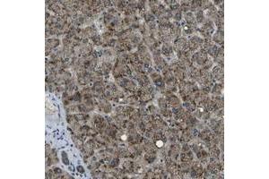 Immunohistochemical staining of human liver with APOBEC4 polyclonal antibody  shows strong granular positivity in hepatocytes. (APOBEC4 抗体)