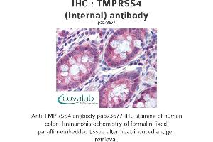Image no. 2 for anti-Transmembrane Protease, serine 4 (TMPRSS4) (Internal Region) antibody (ABIN1740176) (TMPRSS4 抗体  (Internal Region))