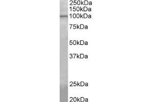 Western Blotting (WB) image for anti-ATP/GTP Binding Protein-Like 5 (AGBL5) (AA 137-149) antibody (ABIN1099865) (AGBL5 抗体  (AA 137-149))
