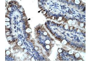 KRT15 antibody was used for immunohistochemistry at a concentration of 4-8 ug/ml to stain Epithelial cells of intestinal villus (arrows) in Human Intestine. (KRT15 抗体  (C-Term))