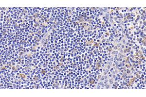 Detection of Bcl2 in Human Amygdalitis Tissue using Monoclonal Antibody to B-Cell Leukemia/Lymphoma 2 (Bcl2)
