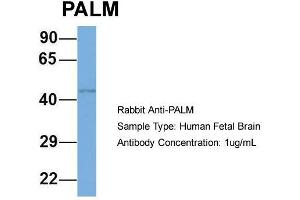 Host: Rabbit  Target Name: PALM  Sample Tissue: Human Fetal Brain  Antibody Dilution: 1. (Paralemmin 抗体  (N-Term))
