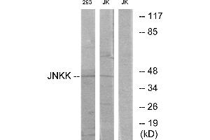 Western blot analysis of extracts from Jurkat cells and 293 cells, using JNKK antibody. (MAP2K4 抗体  (Internal Region))