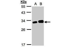 WB Image Sample(30 ug whole cell lysate) A:293T B:HeLa S3, 12% SDS PAGE antibody diluted at 1:1000 (Latexin 抗体)