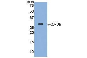 Western blot analysis of recombinant Mouse ITGaD. (ITGAD 抗体  (AA 886-1106))