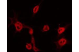 ABIN6267580 staining COS7 by IF/ICC. (CDK5 抗体  (pTyr15))