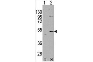 Image no. 1 for anti-Aldehyde Dehydrogenase 5 Family, Member A1 (ALDH5A1) (N-Term) antibody (ABIN356985) (ALDH5A1 抗体  (N-Term))