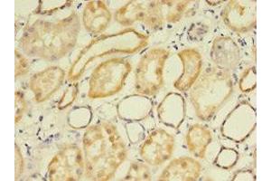 Immunohistochemistry of paraffin-embedded human kidney tissue using ABIN7158118 at dilution of 1:100 (FLRT1 抗体  (AA 21-289))