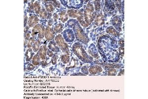 Immunohistochemistry (IHC) image for anti-Proteasome (Prosome, Macropain) 26S Subunit, Non-ATPase, 11 (PSMD11) (C-Term) antibody (ABIN2777703)