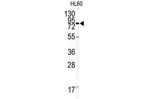 Western blot analysis of CD31 antibody (C-term) in HL60 cell line lysates (35ug/lane). (CD31 抗体  (C-Term))