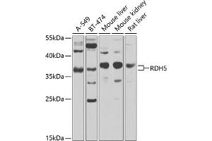 Western blot analysis of extracts of various cell lines, using RDH5 antibody (ABIN6130851, ABIN6146839, ABIN6146840 and ABIN6224076) at 1:1000 dilution. (RDH5 抗体  (AA 24-318))
