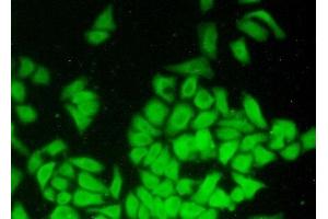 Detection of COTL1 in Hela cells using Polyclonal Antibody to Coactosin Like Protein 1 (COTL1) (COTL1 抗体  (AA 1-142))