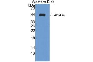 Detection of Recombinant S100B, Bovine using Polyclonal Antibody to S100 Calcium Binding Protein B (S100B) (S100B 抗体  (AA 1-92))