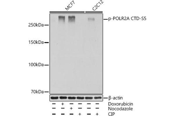 POLR2A/RPB1 抗体  (pSer5)