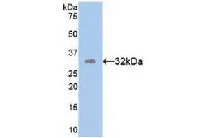 Detection of Recombinant TR1, Human using Polyclonal Antibody to Tomoregulin 1 (TR1) (TMEFF1 抗体  (AA 79-333))
