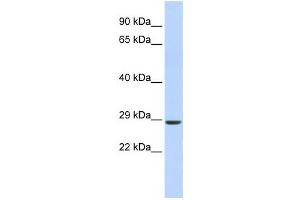 Western Blotting (WB) image for anti-SIX Homeobox 2 (SIX2) antibody (ABIN2458374) (SIX2 抗体)