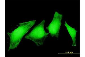 Immunofluorescence of monoclonal antibody to ASPA on HeLa cell. (ASPA 抗体  (AA 1-100))