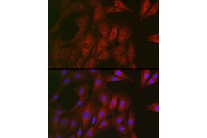 Immunofluorescence analysis of NIH/3T3 cells using RTKN Rabbit pAb (ABIN6129097, ABIN6147290, ABIN6147292 and ABIN6222455) at dilution of 1:100 (40x lens). (Rhotekin 抗体  (AA 254-513))