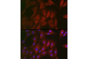 Immunofluorescence analysis of NIH/3T3 cells using RTKN Rabbit pAb (ABIN6129097, ABIN6147290, ABIN6147292 and ABIN6222455) at dilution of 1:100 (40x lens). (Rhotekin 抗体  (AA 254-513))