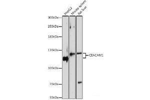 Western blot analysis of extracts of various cell lines using CEACAM1 Polyclonal Antibody at dilution of 1:1000. (CEACAM1 抗体)