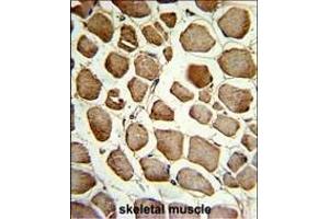 Formalin-fixed and paraffin-embedded human skeletal muscle reacted with CKIP-1 Antibody (N-term), which was peroxidase-conjugated to the secondary antibody, followed by DAB staining. (PLEKHO1 抗体  (N-Term))