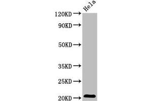 Western Blot Positive WB detected in: Hela whole cell lysate All lanes: ARL1 antibody at 5. (ARL1 抗体  (AA 2-181))