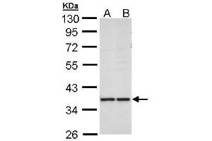 WB Image Sample (30 ug of whole cell lysate) A: MOLT4 , B: Raji , 10% SDS PAGE antibody diluted at 1:1000