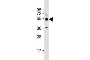 Western blot testing of human ovary lysate with SH3BP5 antibody at 1:2000. (SH3BP5 抗体  (AA 63-97))