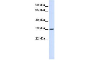 VTI1A antibody used at 1 ug/ml to detect target protein. (VTI1A 抗体)