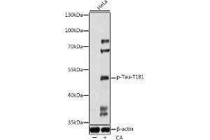 Western blot analysis of extracts of HeLa cells, using Phospho-Tau-T181 antibody (ABIN7268528) at 1:1000 dilution. (MAPT 抗体  (pThr181))
