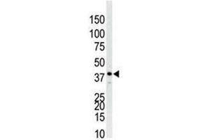 Western Blotting (WB) image for anti-Mitogen-Activated Protein Kinase 14 (MAPK14) (AA 295-324) antibody (ABIN3031831)