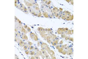 Immunohistochemistry of paraffin-embedded human gastric using OGFR antibody at dilution of 1:100 (x40 lens). (OGFR 抗体)